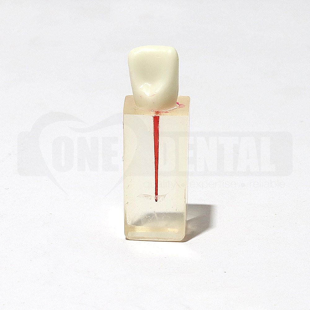 Root canal block U1 Central Tooth with Crown