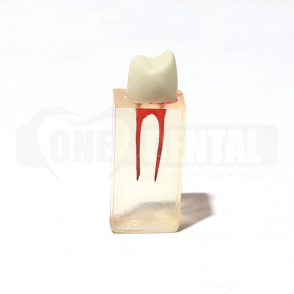 Root canal block U4 Premolar with crown
