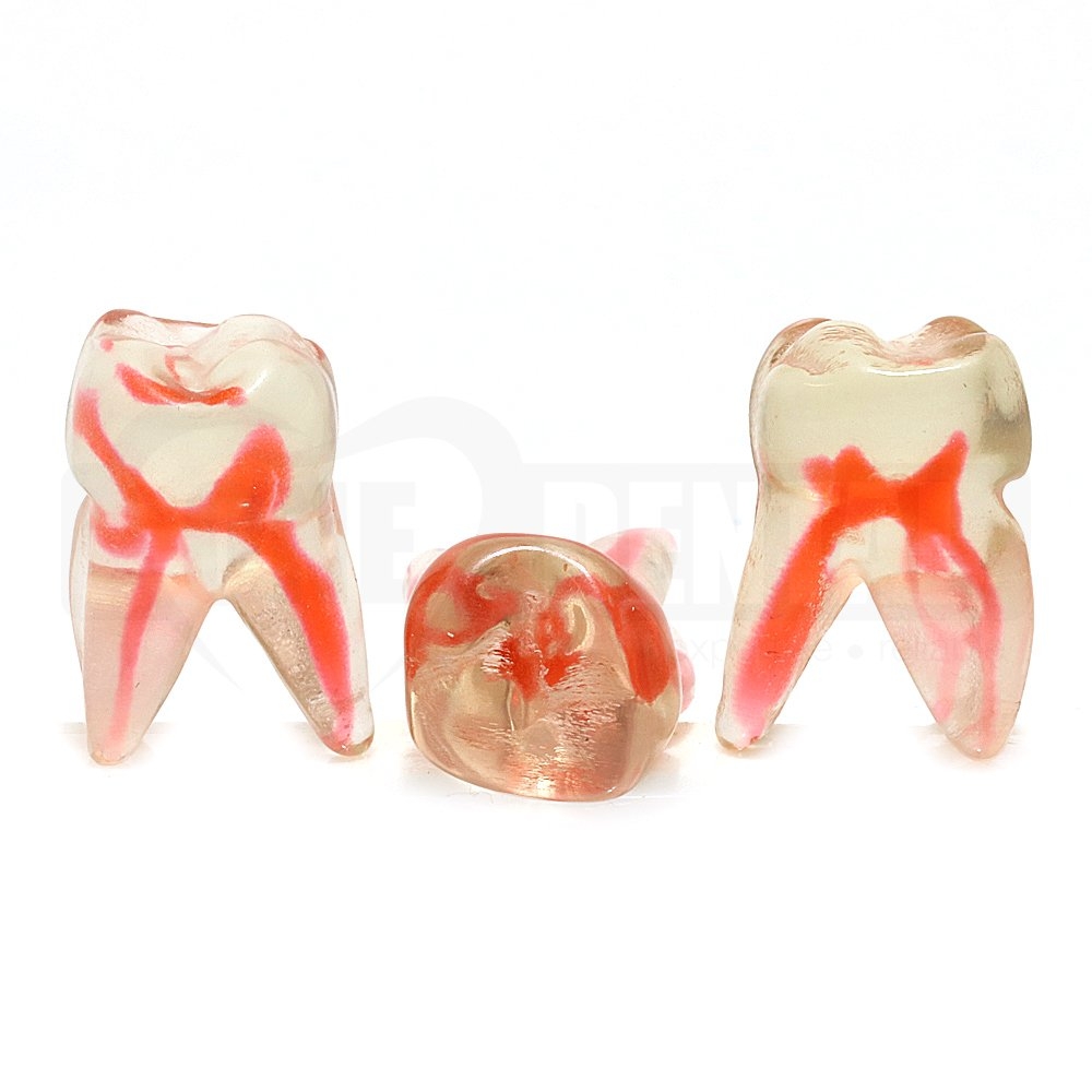 Natural Rooth Endo Tooth 16 Transparent MB1 and MB2