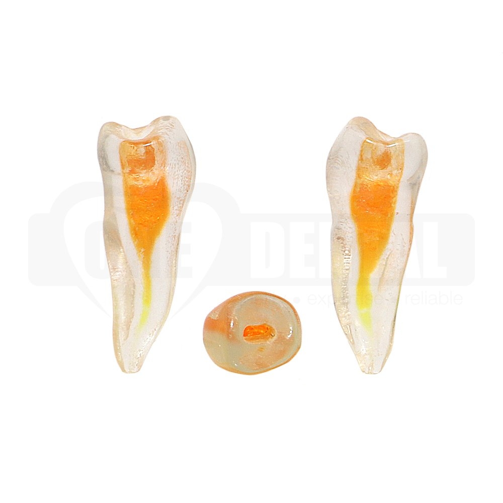 Natural Root Endo Tooth 45 with Access Cavity