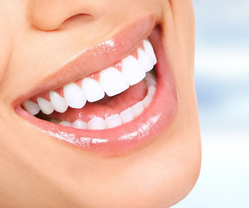 Woman smiling with bright teeth