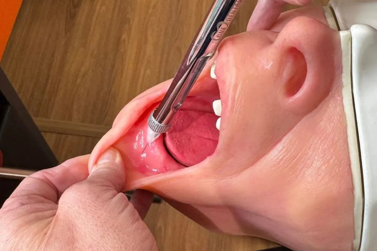 Photo of a mouth