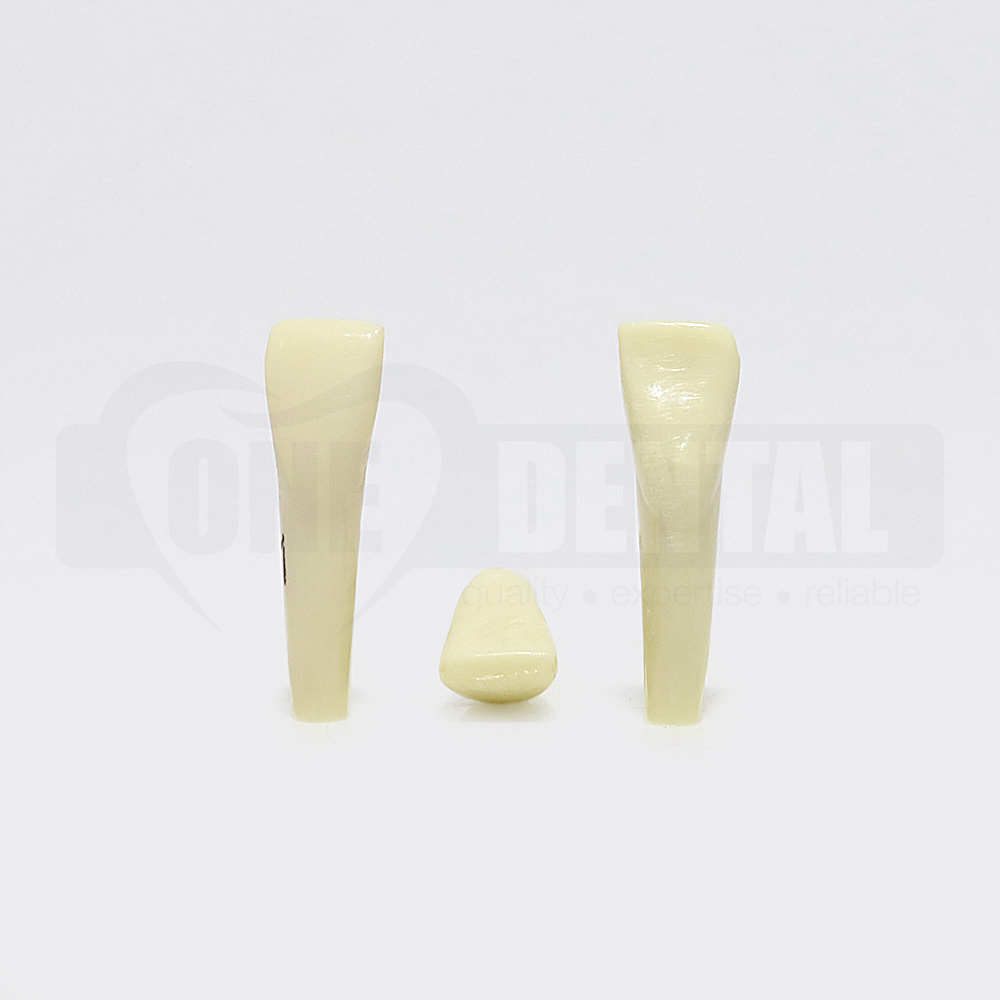 Tooth 41 for Paedo Model 1971