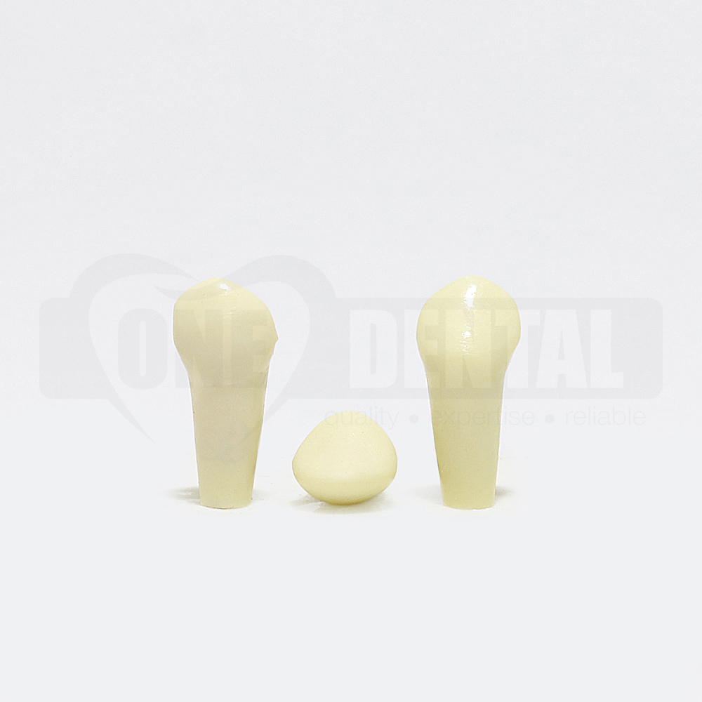 Tooth 53 for Paedo Model 1971