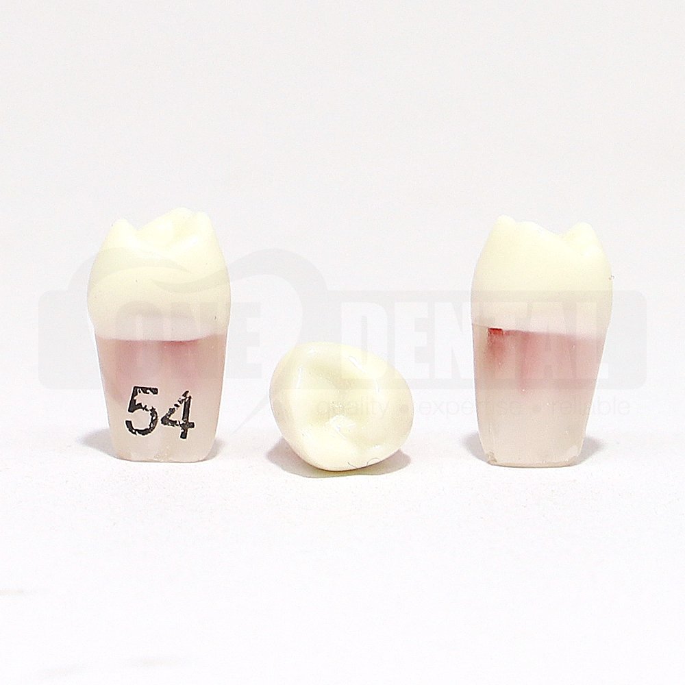 Pulpotomy Tooth 54 + screw for 1971 Paedo Model