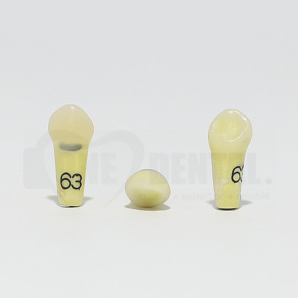 Caries Tooth 63 Buccal for 1974 Paedo Model