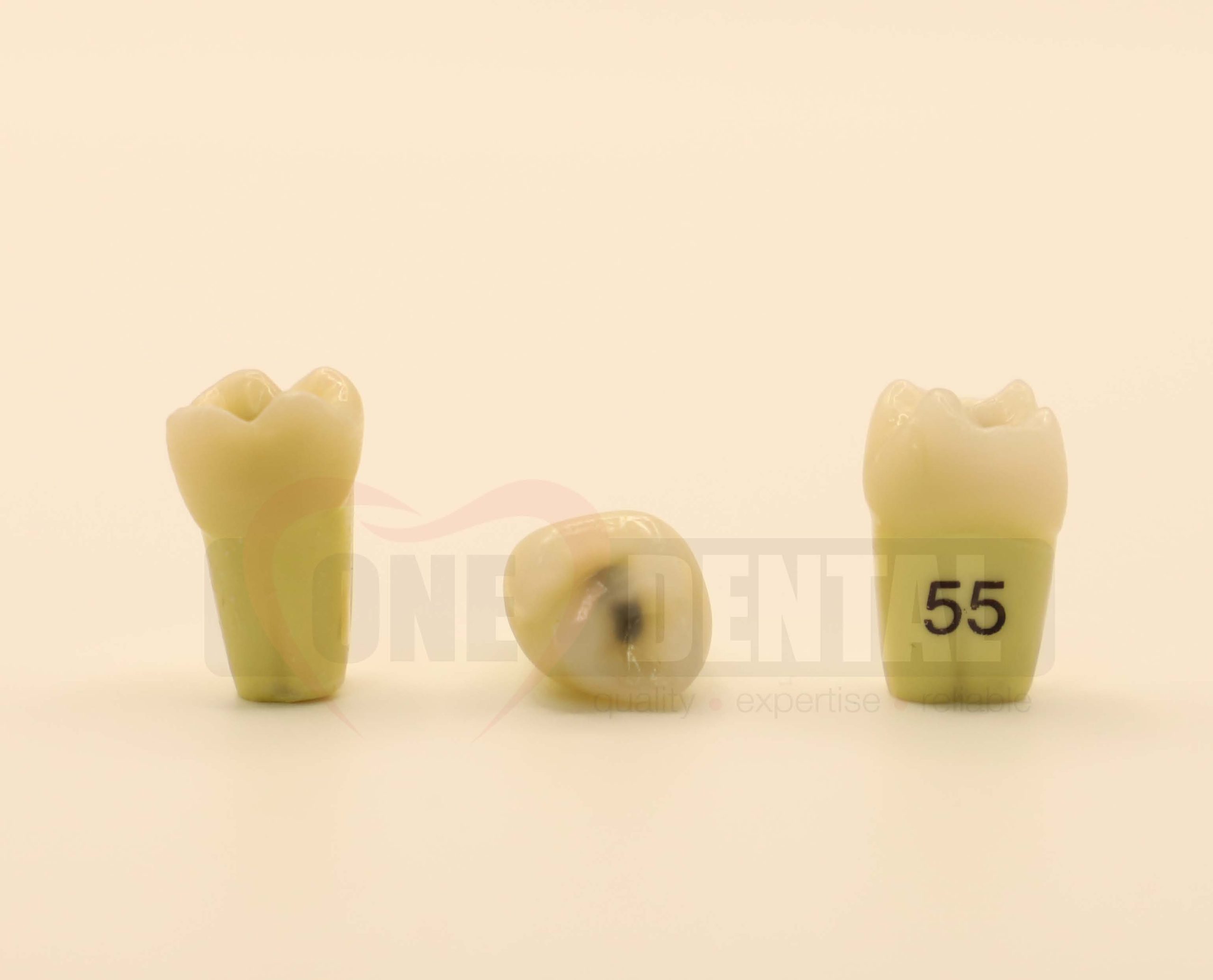 Caries Tooth 55 Occ for 1971 Paedo Model