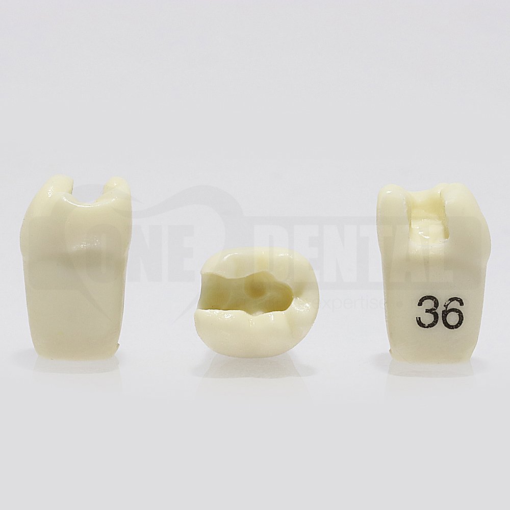 Prep Tooth 36MO GW for 1971 Paedo Model
