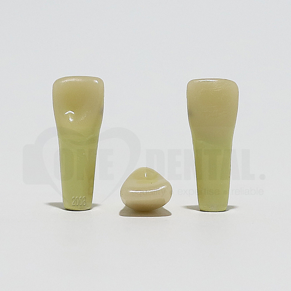 Caries Tooth 11M  for 2008 Adult Model