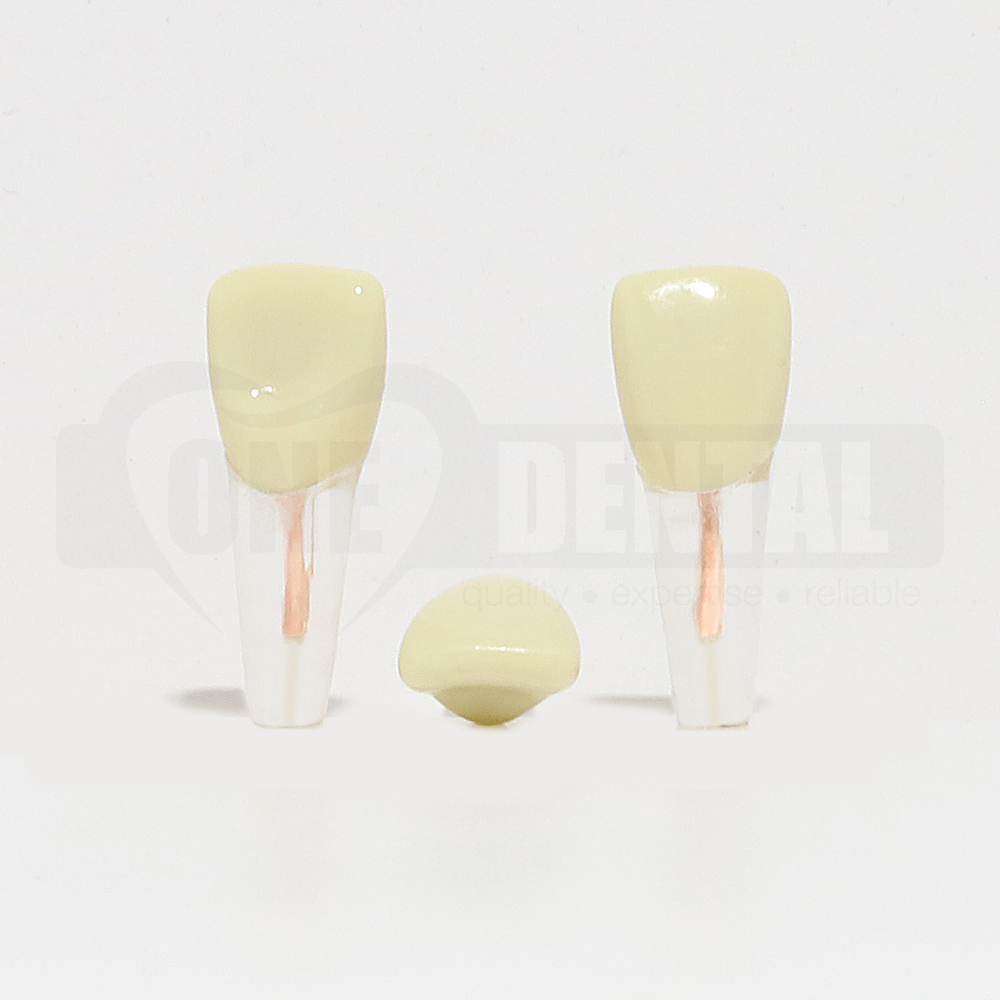 Tooth 11 Endo Gutta Percha Filled With Crown for 2008 Adult Model