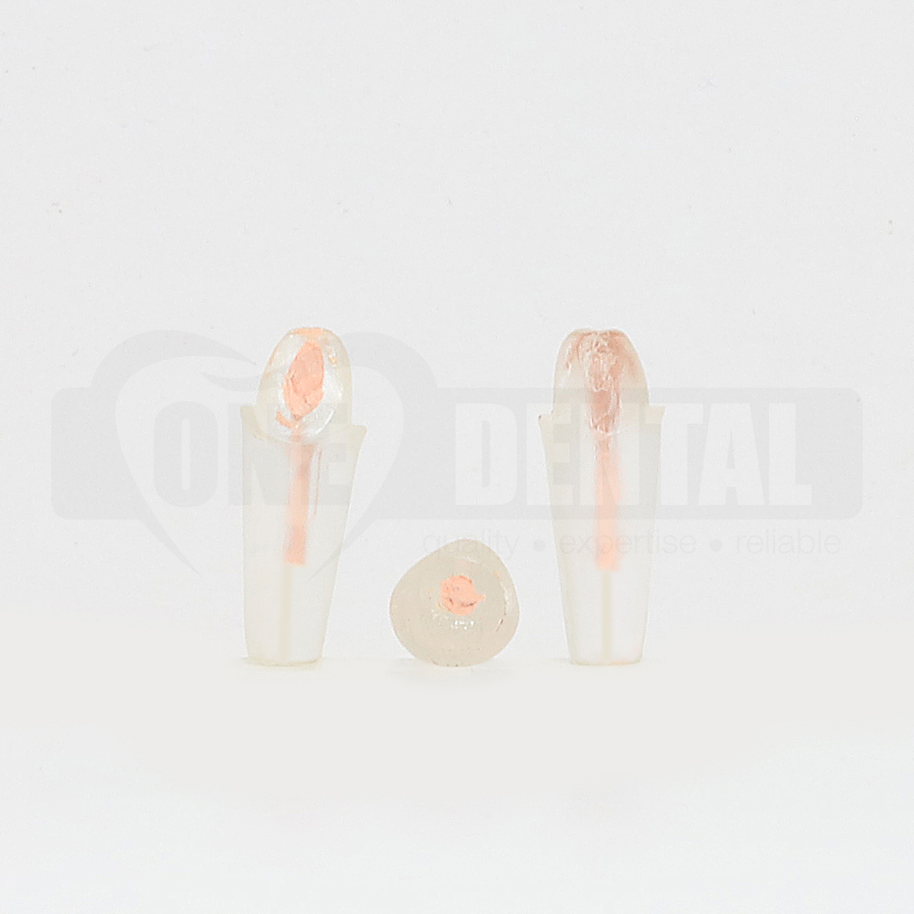 Tooth 11 Endo Gutta Percha Filled and  Full Crown Prep for 2008 Adult Model