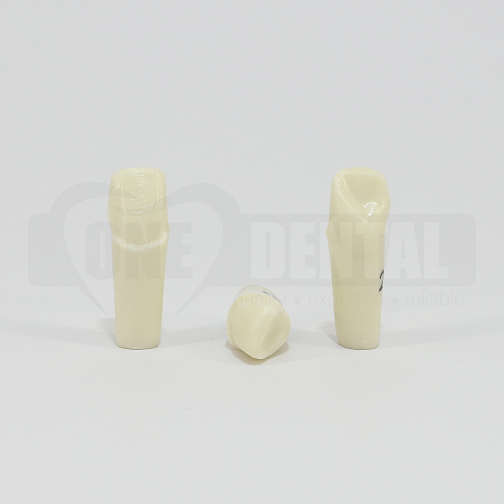 Prep Tooth 21 Veneer MMAND for 2008 Adult Model