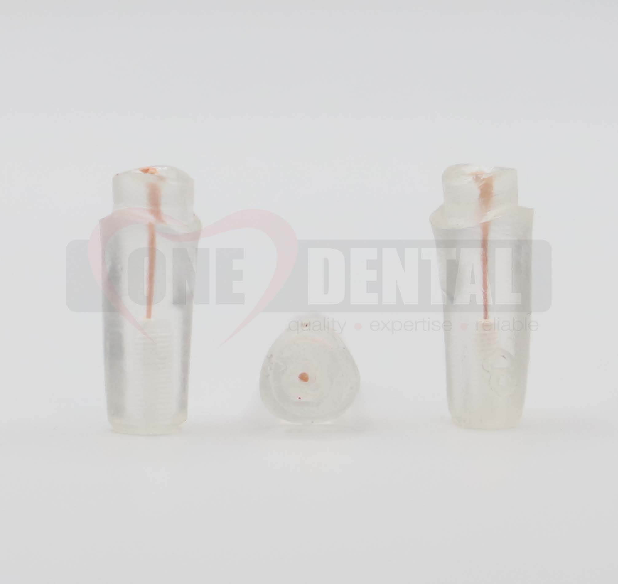 Tooth 11 Gutta Percha Filled for Post & Core with NO Crown Prep for 2010 Adult Model