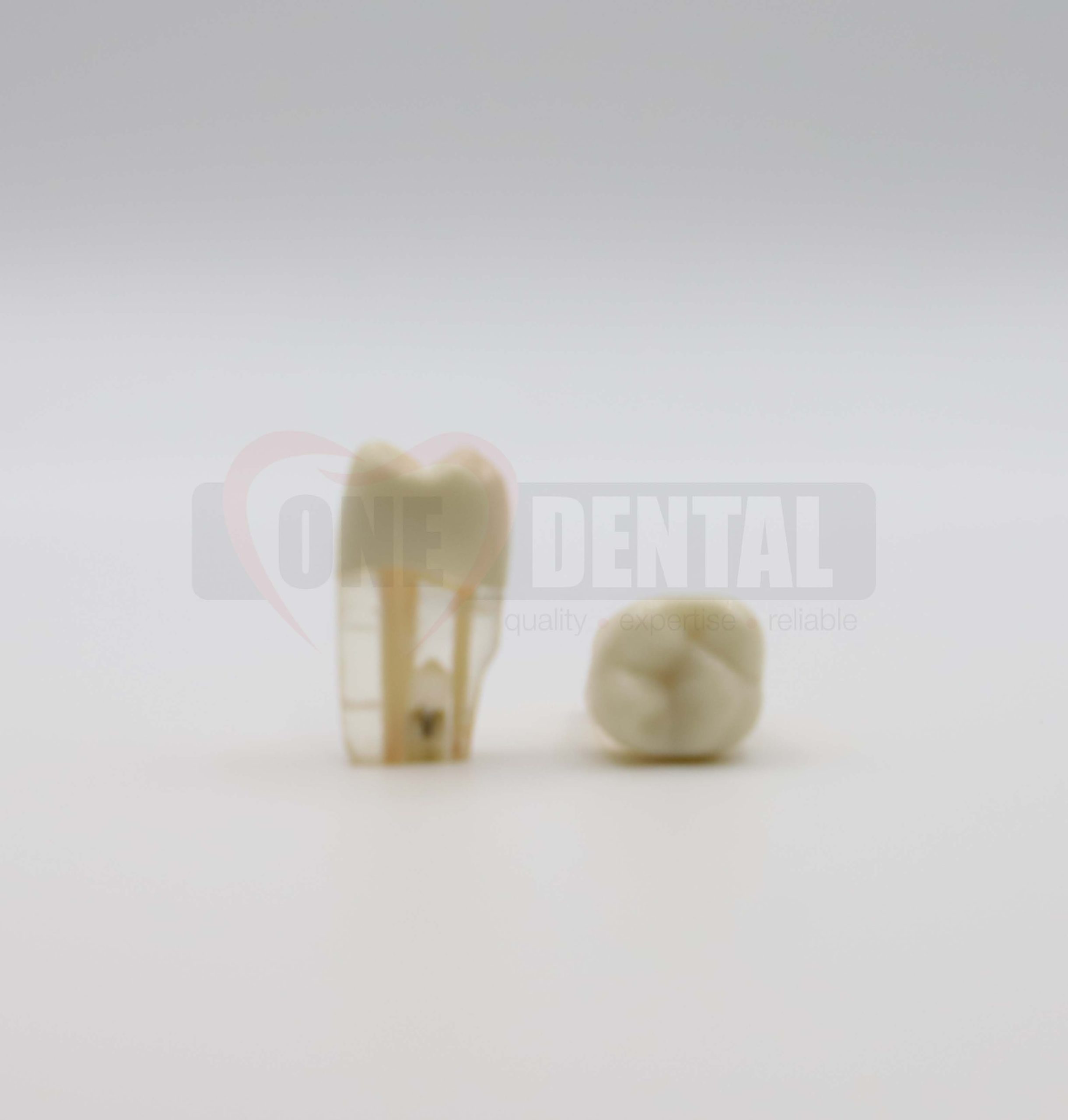 Tooth 26 Endo Gutta Percha filled PN for 2010 Adult Model