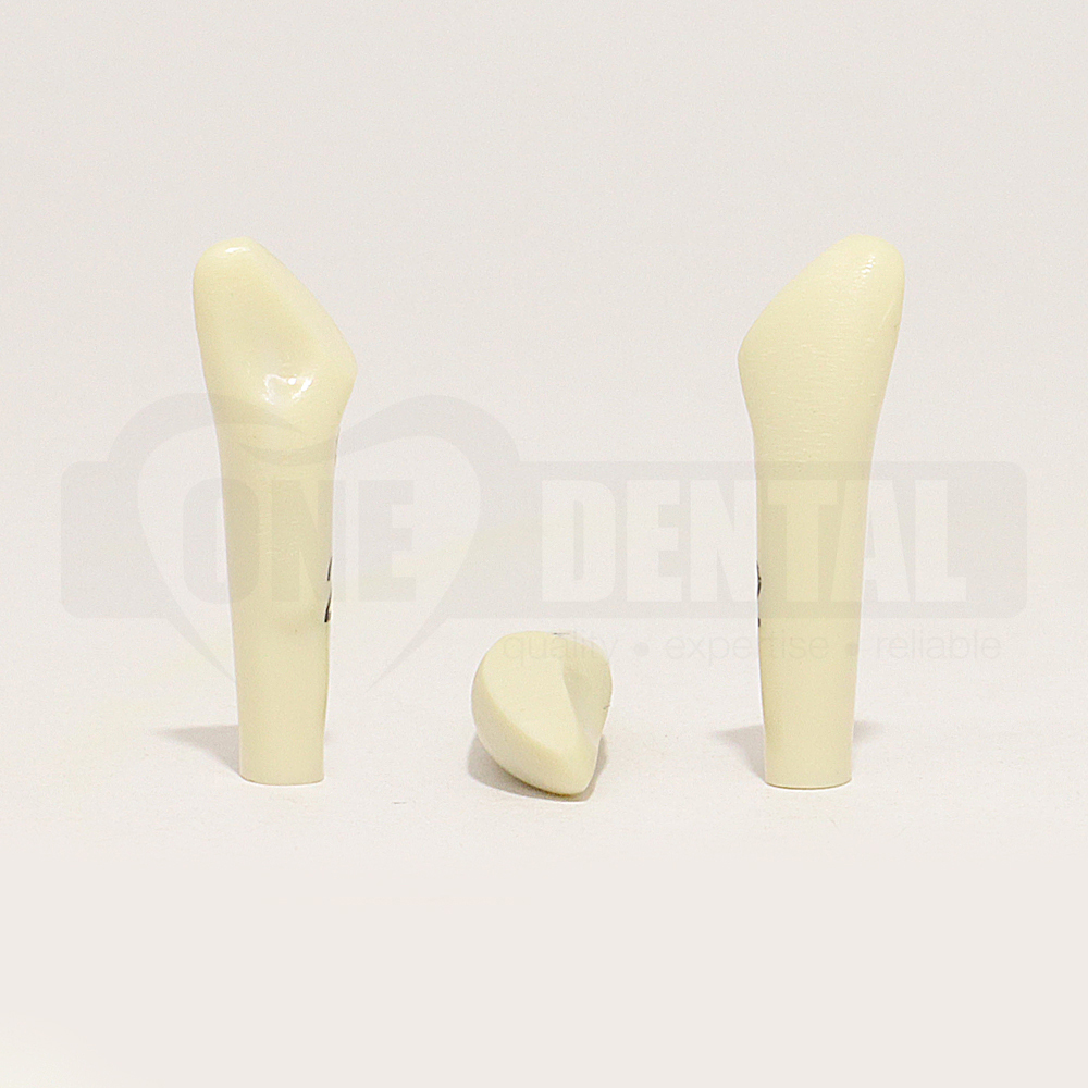 Prep Tooth 22 Distal Incisal Fracture PC for 2010 Adult Model