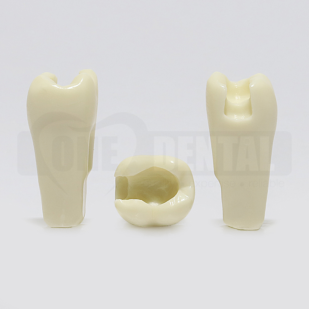 Prep Tooth 37 MO - JK for 2010 Adult Model