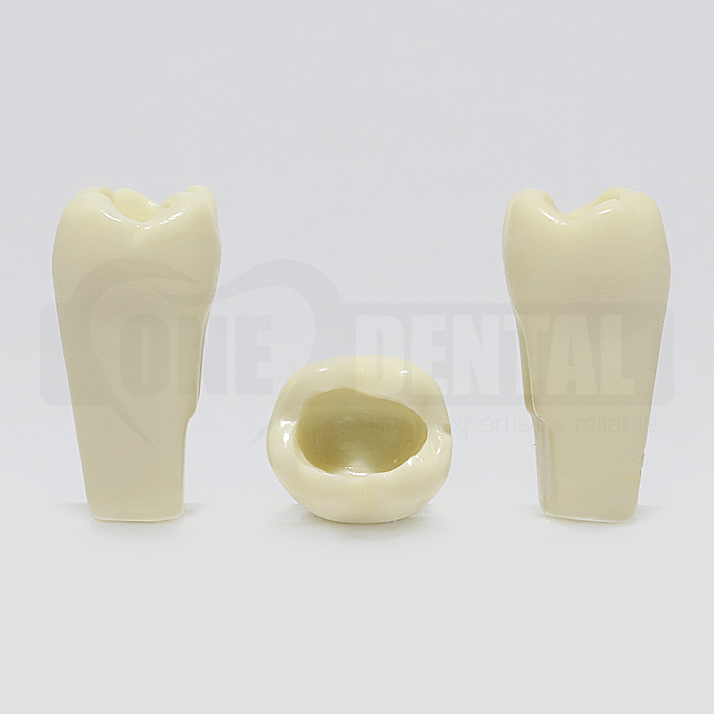 Prep Tooth 46 OCC ACP - JK for 2010 Adult Model