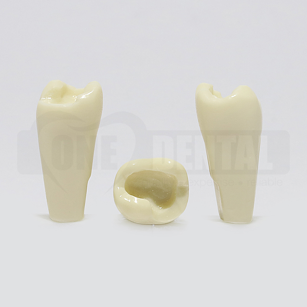 Prep Tooth 47 MOB - JK for 2010 Adult Model