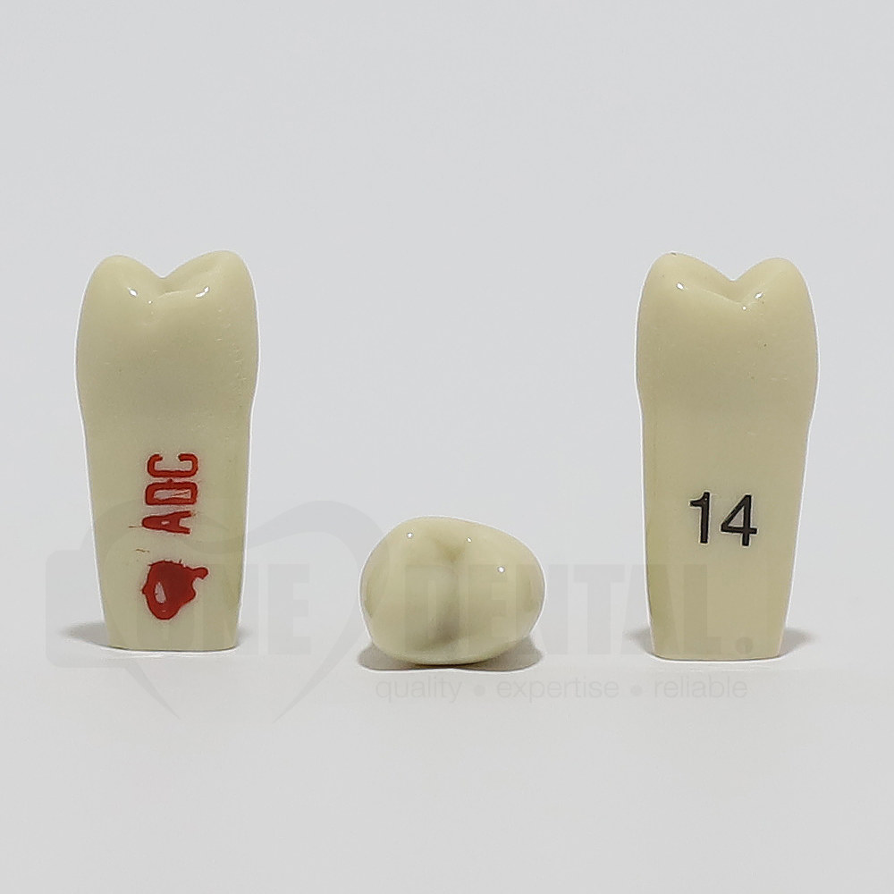 ADC Tooth 14 for ADC Model