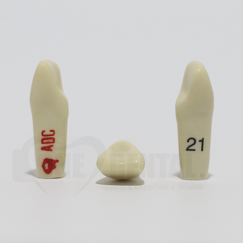 ADC Tooth 21 for ADC Model