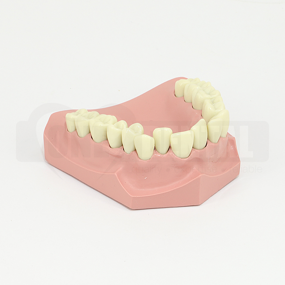 Ortho Model with crowded upper anteriors