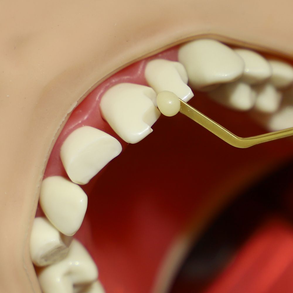 2008 Adult Prep Teeth