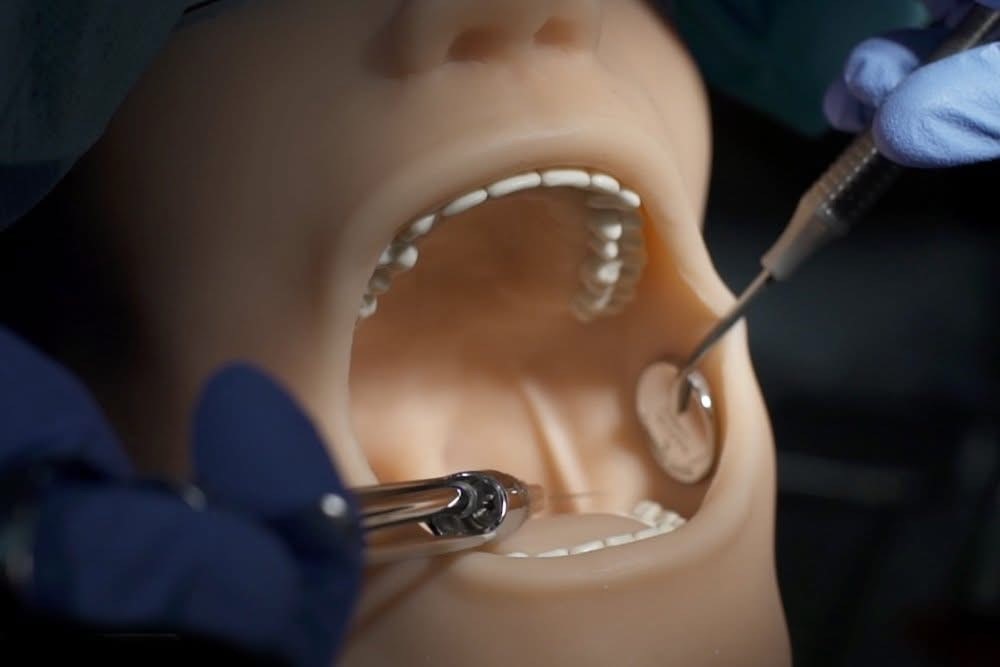 Atraumatic Extraction of Primary Teeth