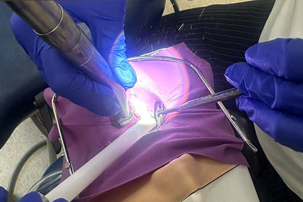 Managing Pulps & Pain in Primary Teeth
